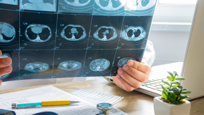 Pneumologue analysant une radiologie des poumons 